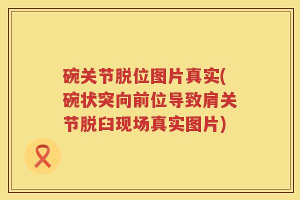 碗关节脱位图片真实(碗状突向前位导致肩关节脱臼现场真实图片) 碗关节脱位图片真实(碗状突向前位导致肩关节脱臼现场真实图片)