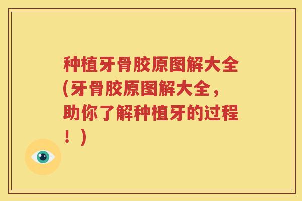 种植牙骨胶原图解大全(牙骨胶原图解大全，助你了解种植牙的过程！)
