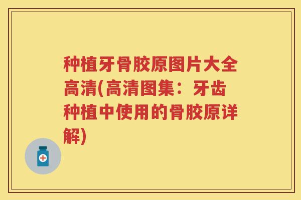 种植牙骨胶原图片大全高清(高清图集:牙齿种植中使用的骨胶原详解) 种植牙骨胶原图片大全高清(高清图集:牙齿种植中使用的骨胶原详解)
