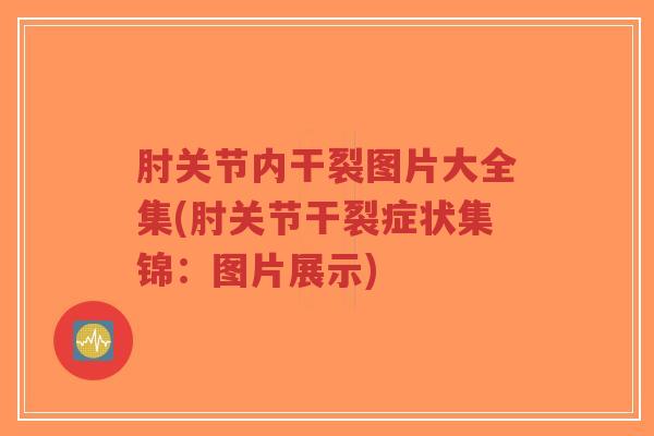 肘关节内干裂图片大全集(肘关节干裂症状集锦:图片展示) 肘关节内干裂图片大全集(肘关节干裂症状集锦:图片展示)