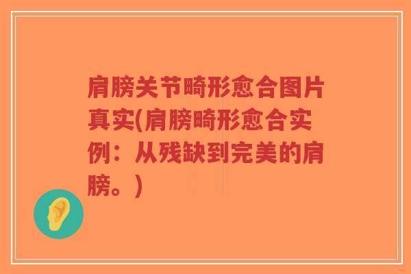 肩膀关节畸形愈合图片真实(肩膀畸形愈合实例:从残缺到完美的肩膀。) 肩膀关节畸形愈合图片真实(肩膀畸形愈合实例:从残缺到完美的肩膀。)