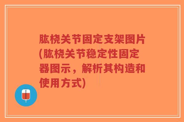 肱桡关节固定支架图片(肱桡关节稳定性固定器图示,解析其构造和使用方式) 肱桡关节固定支架图片(肱桡关节稳定性固定器图示,解析其构造和使用方式)