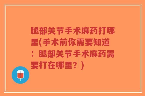 腿部关节手术麻药打哪里(手术前你需要知道:腿部关节手术麻药需要打在哪里?) 腿部关节手术麻药打哪里(手术前你需要知道:腿部关节手术麻药需要打在哪里?)
