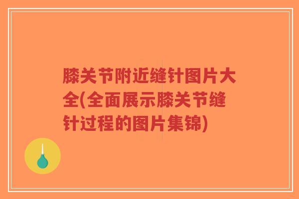 膝关节附近缝针图片大全(全面展示膝关节缝针过程的图片集锦) 膝关节附近缝针图片大全(全面展示膝关节缝针过程的图片集锦)