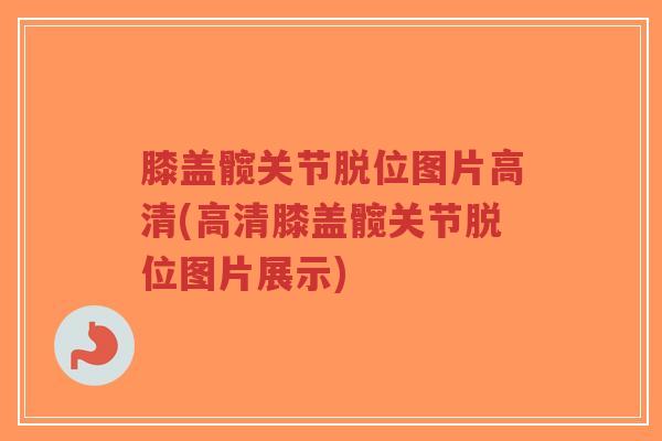 膝盖髋关节脱位图片高清(高清膝盖髋关节脱位图片展示) 膝盖髋关节脱位图片高清(高清膝盖髋关节脱位图片展示)
