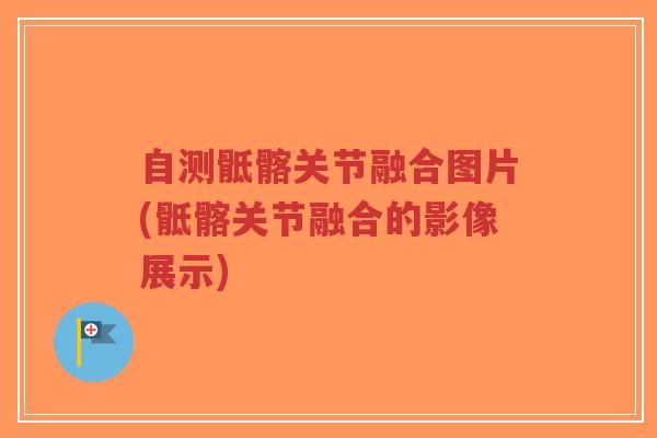 自测骶髂关节融合图片(骶髂关节融合的影像展示) 自测骶髂关节融合图片(骶髂关节融合的影像展示)