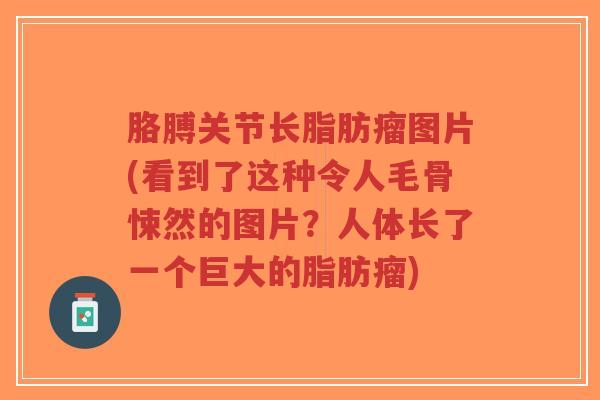 胳膊关节长脂肪瘤图片(看到了这种令人毛骨悚然的图片?人体长了一个巨大的脂肪瘤) 胳膊关节长脂肪瘤图片(看到了这种令人毛骨悚然的图片?人体长了一个巨大的脂肪瘤)