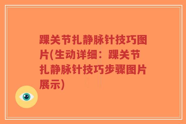 踝关节扎静脉针技巧图片(生动详细:踝关节扎静脉针技巧步骤图片展示) 踝关节扎静脉针技巧图片(生动详细:踝关节扎静脉针技巧步骤图片展示)