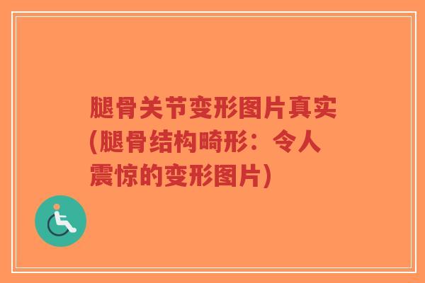 腿骨关节变形图片真实(腿骨结构畸形:令人震惊的变形图片) 腿骨关节变形图片真实(腿骨结构畸形:令人震惊的变形图片)