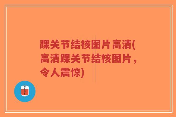 踝关节结核图片高清(高清踝关节结核图片，令人震惊)