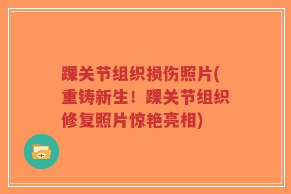 踝关节组织损伤照片(重铸新生!踝关节组织修复照片惊艳亮相) 踝关节组织损伤照片(重铸新生!踝关节组织修复照片惊艳亮相)